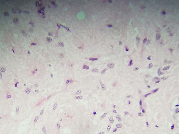Pituitary Gland Slides - Pituitary Gland 010 400X